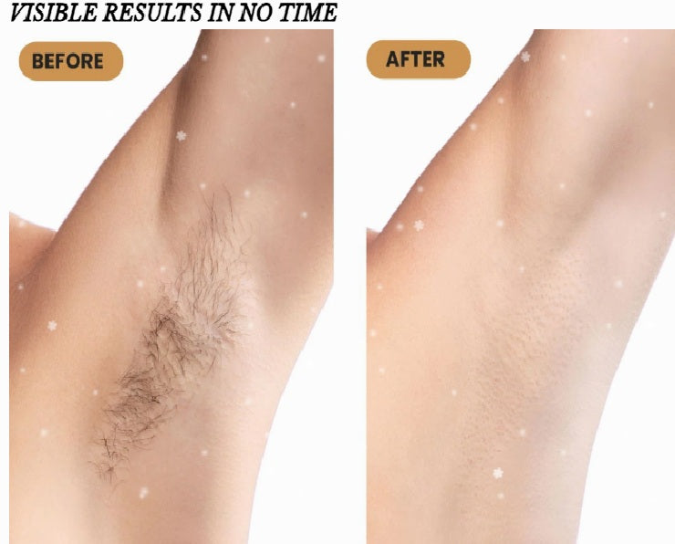 IPL Hair Removal Laser Epilator Women